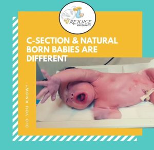 babies born section system immune differences natural did know